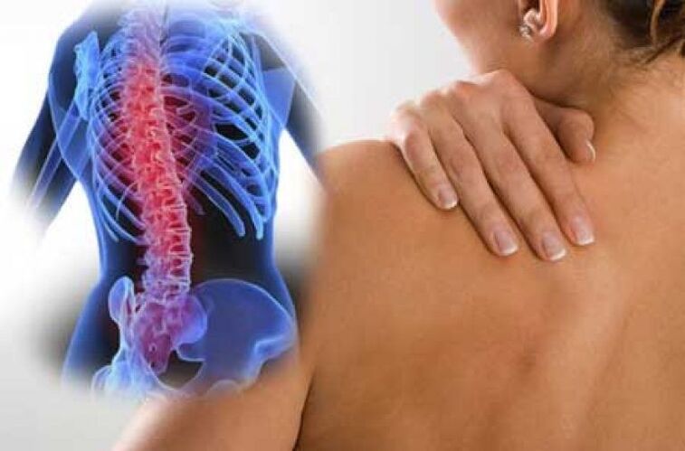 ოსტეოქონდროზის დროს ტკივილი შეიძლება გავრცელდეს სხეულის შორეულ ნაწილებში