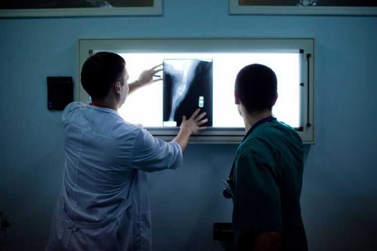 ართროზის დიაგნოზი x -ray- ზე